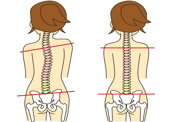 股関節の痛み・違和感の原因は骨盤のゆがみからきている