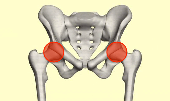 股関節の痛み・違和感患者のイメージ